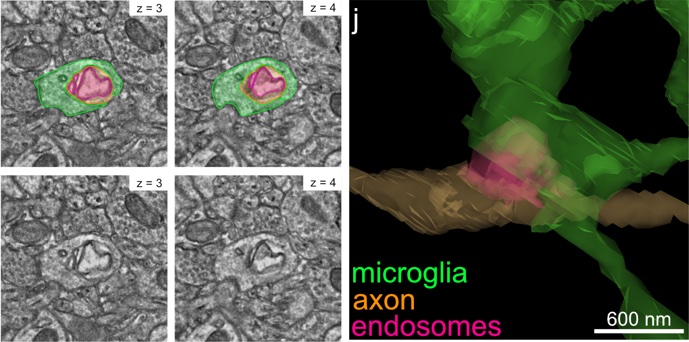 Electron microscopy and 3D reconstruction of a microglial cell extracting endosomes from an axon (Fig. 4i–j, Pepper et al. 2026, CC BY 4.0)