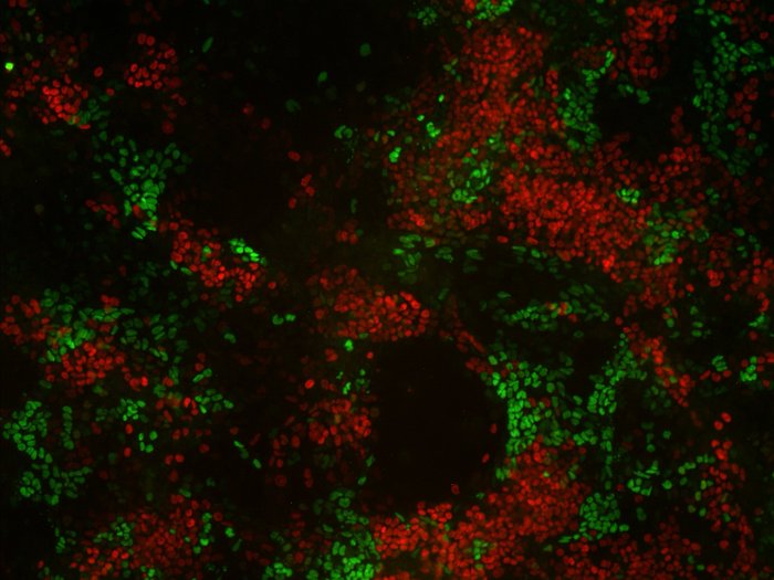 Fluorescence microscopy image showing stem cells differentiating towards a neural identity