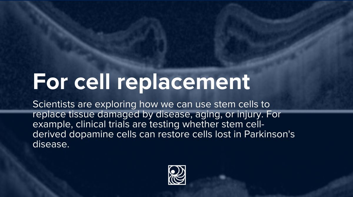 Stem cells and Parkinson's Disease — ISSCR
