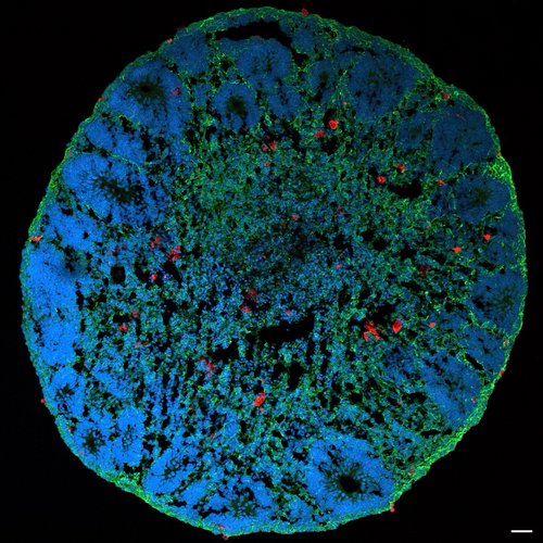 Complete neuroimmune assembloid