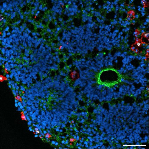 Zoomed detail of neuroimmune assembloid