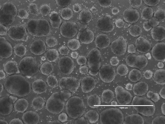 Brightfield microscopy image of iPSC-derived spheroids